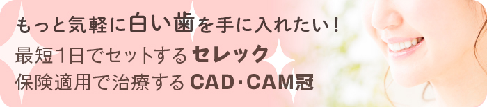 セレック・保険適用で治療するのCAD/CAM冠