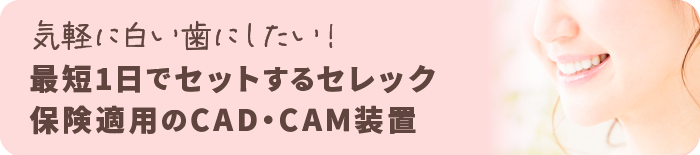 セレック・保険適用で治療するCAD/CAM装置